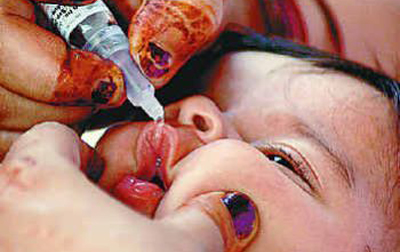 polio drop 400