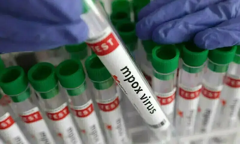 Seven newborn deaths in Khairpur not directly caused by Mpox: health ministry