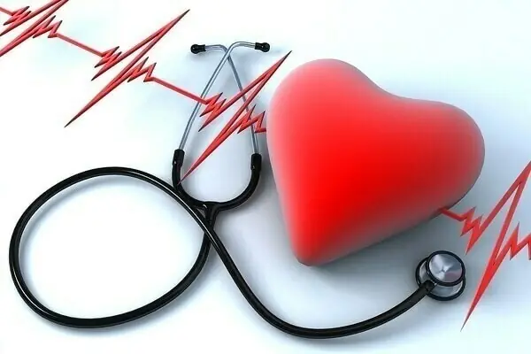 Pakistani women face the region’s highest heart disease death rate: experts