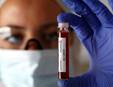 Global licence deal to provide COVID antibody test tech free to poorer countries: WHO