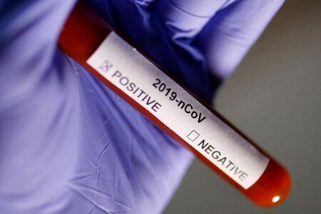 World's first COVID human challenge trial found to be safe in young adults