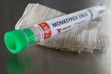 First case of monkeypox confirmed in Finland