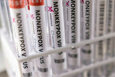 People infected with monkeypox can isolate at home: UKHSA