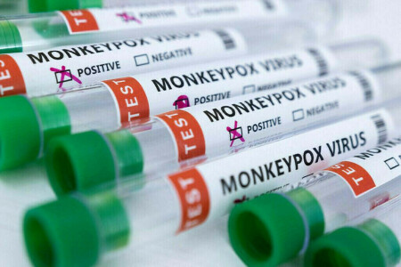 South Korea reports first imported case of monkeypox