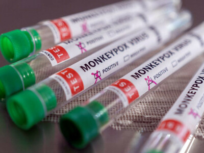 India reports first case of monkeypox