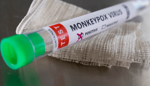 First monkeypox case reported in Karachi