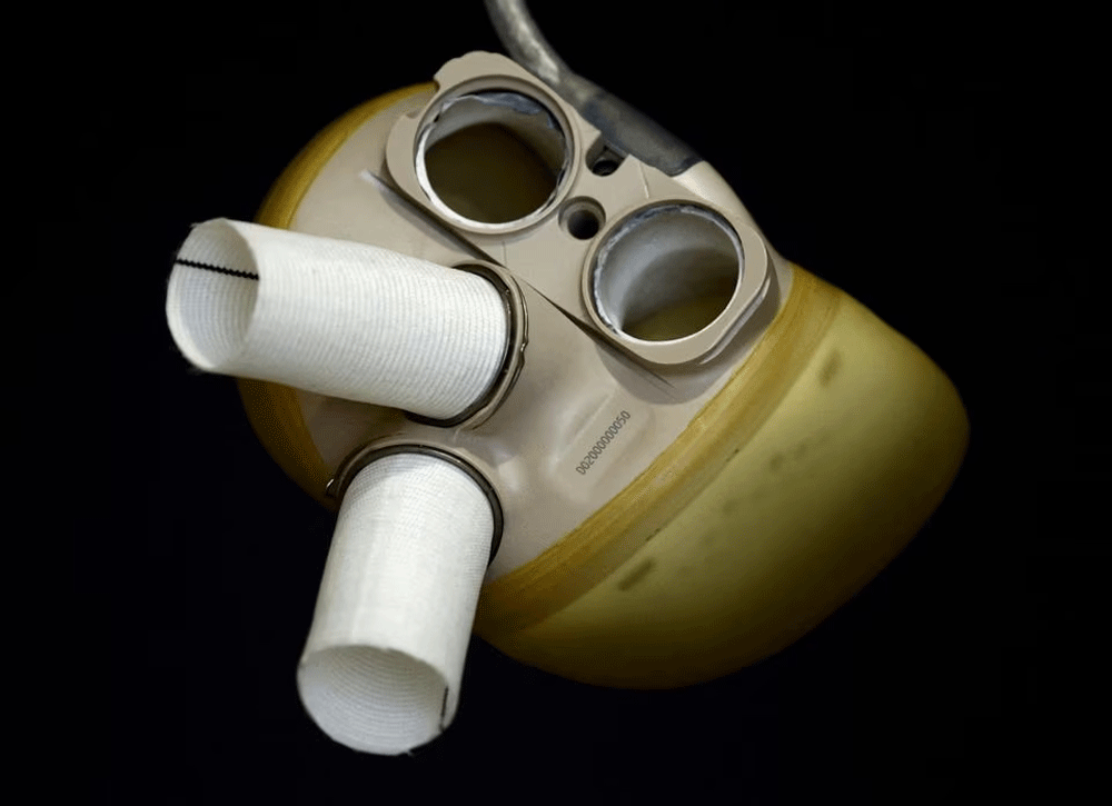 Artificial heart maker Carmat completes 7mn euro capital increase Artificial heart maker Carmat completes 7mn euro capital increase
