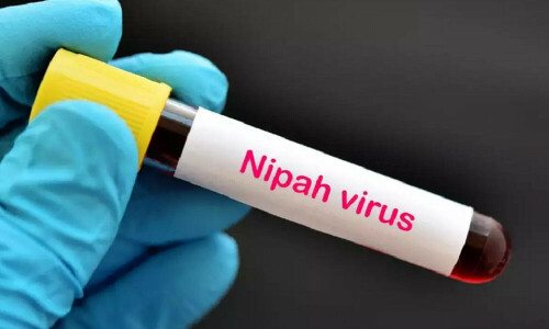 Bangladesh reports first death from Nipah virus this year
