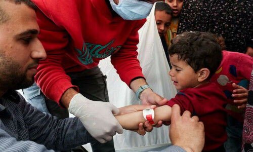 Gaza doctors measure children for malnutrition
