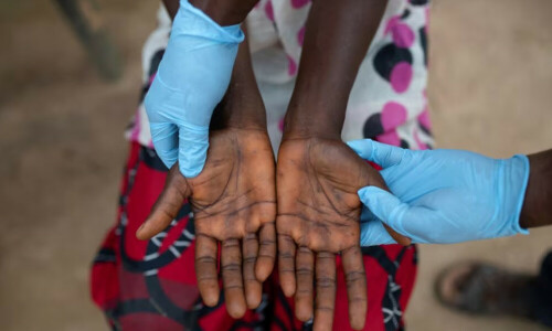 About 3,000 types of skin diseases treatable: experts