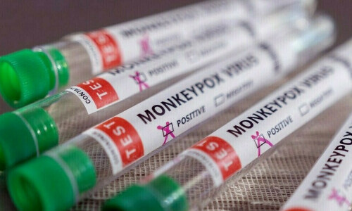 Pakistan confirms mpox case is not new strain