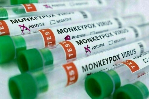 India reports first case of mpox from fast-spreading clade 1b variety