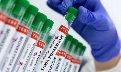 France identifies first case of new mpox variant, AFP reports