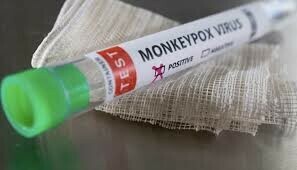 Mpox: health dept for ensuring strict screening steps at Karachi airport