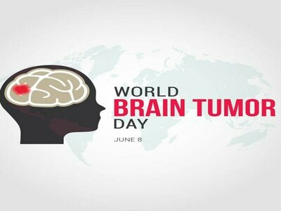 Number of people living with brain tumours increasing: experts