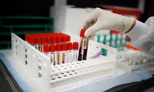 Values of blood collection tubes re-determined