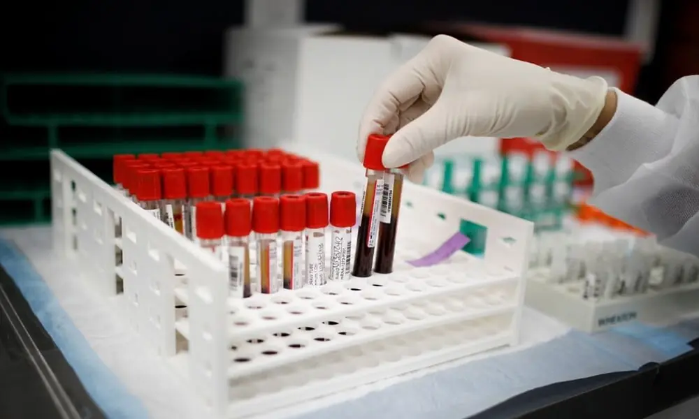 Values of blood collection tubes re-determined - Business & Finance ...