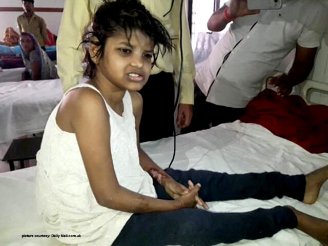 Girl found living with monkeys and walking on all fours Girl found living with monkeys and walking on all fours