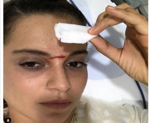 Bollywood 'Queen' Kangana Ranuat suffers life threatening injury Bollywood 'Queen' Kangana Ranuat suffers life threatening injury