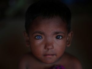 Two colors eyes