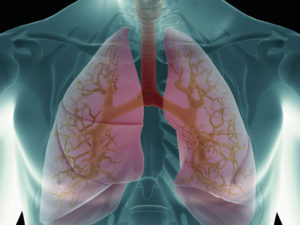 Lung cancer rates in young US women exceed men, despite fewer smokers: study